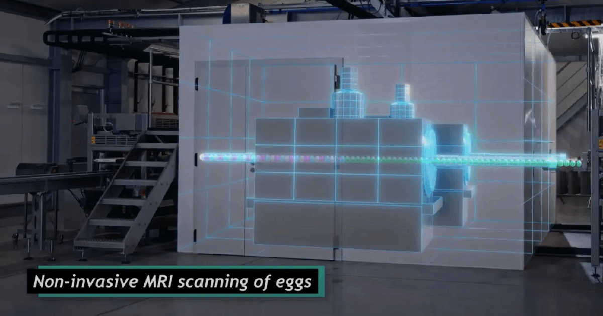 PhD Research Making Waves in the Medical Imaging Market: A Spotlight on AI for MRI Patents